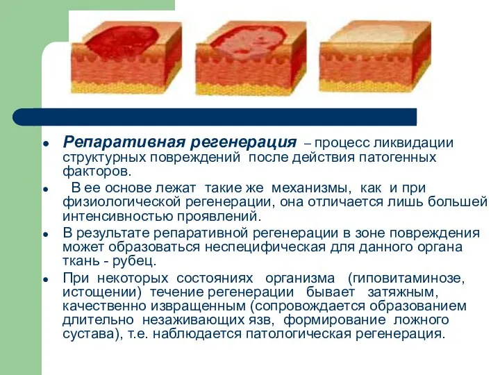 Репаративная регенерация – процесс ликвидации структурных повреждений после действия патогенных факторов.