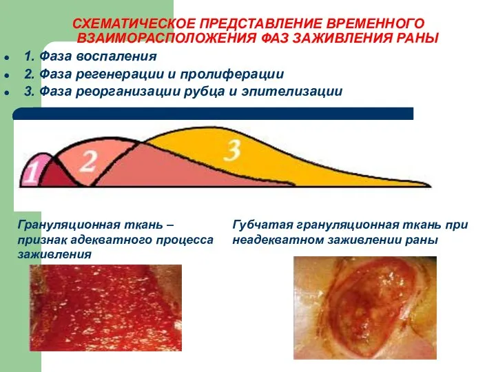 СХЕМАТИЧЕСКОЕ ПРЕДСТАВЛЕНИЕ ВРЕМЕННОГО ВЗАИМОРАСПОЛОЖЕНИЯ ФАЗ ЗАЖИВЛЕНИЯ РАНЫ 1. Фаза воспаления 2.