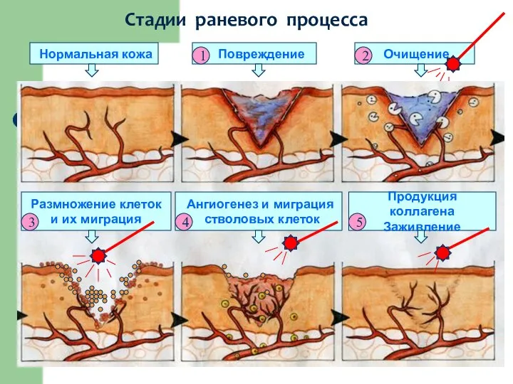 Нормальная кожа Повреждение Очищение Размножение клеток и их миграция Ангиогенез и