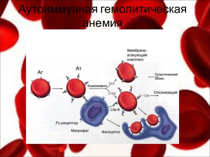 Аутоиммунная гемолитическая анемия