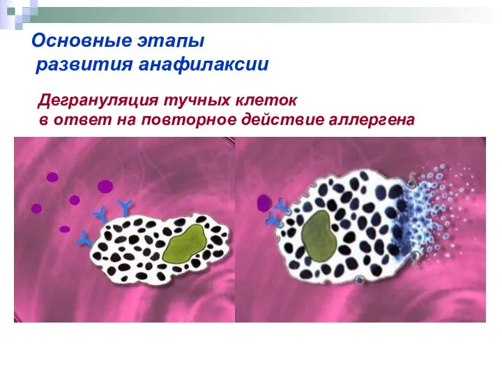 Основные этапы развития анафилаксии Дегрануляция тучных клеток в ответ на повторное действие аллергена