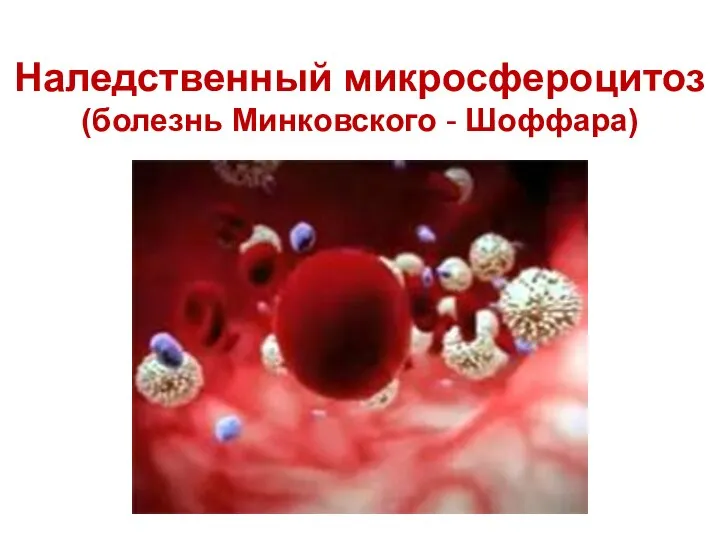 Наледственный микросфероцитоз (болезнь Минковского - Шоффара)