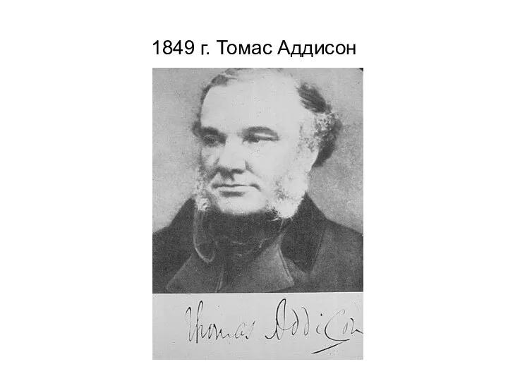1849 г. Томас Аддисон