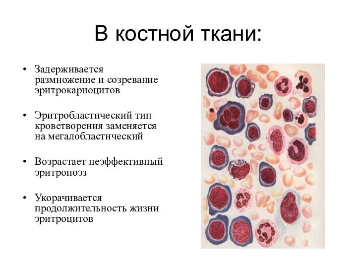 В костной ткани: Задерживается размножение и созревание эритрокариоцитов Эритробластический тип кроветворения