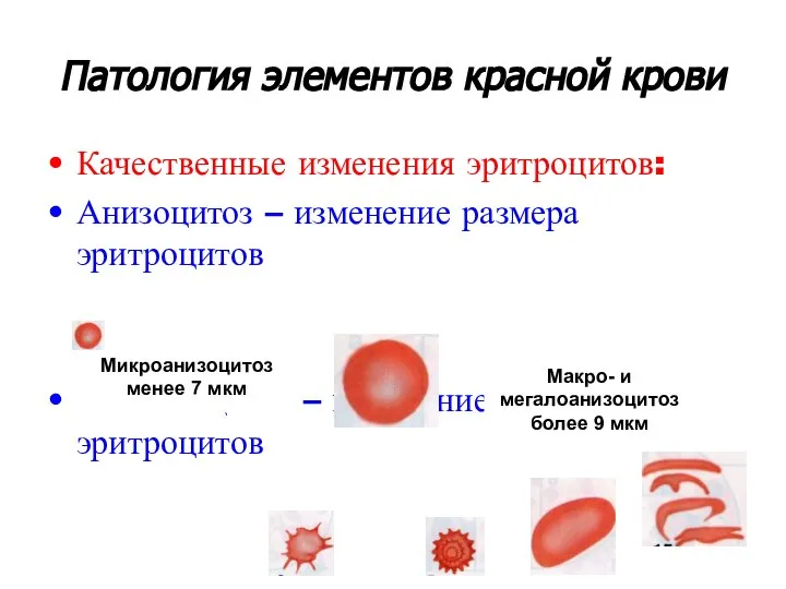 Патология элементов красной крови Качественные изменения эритроцитов: Анизоцитоз – изменение размера