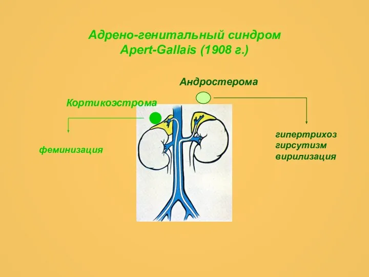 Адрено-генитальный синдром Apert-Gallais (1908 г.) Андростерома Кортикоэстрома феминизация гипертрихоз гирсутизм вирилизация