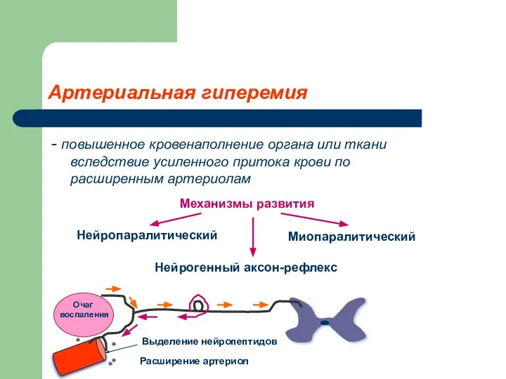 Артериальная гиперемия - повышенное кровенаполнение органа или ткани вследствие усиленного притока