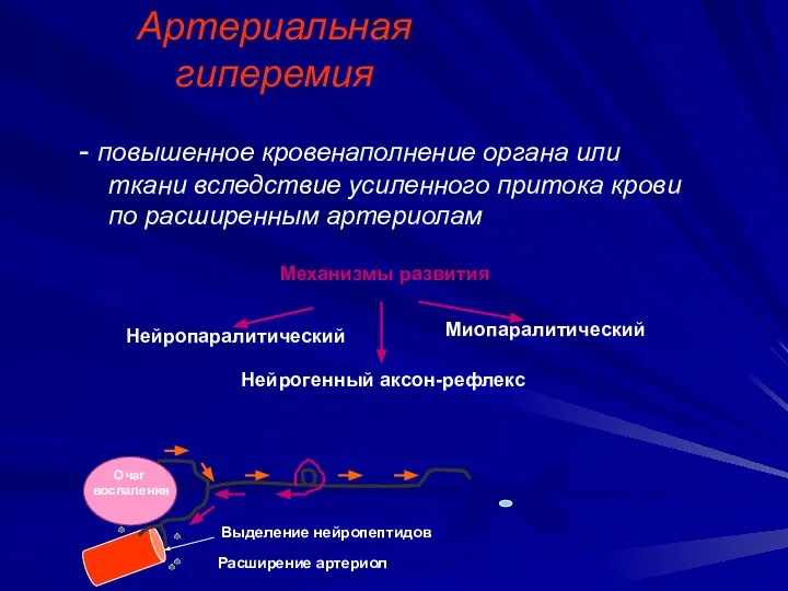 Артериальная гиперемия - повышенное кровенаполнение органа или ткани вследствие усиленного притока