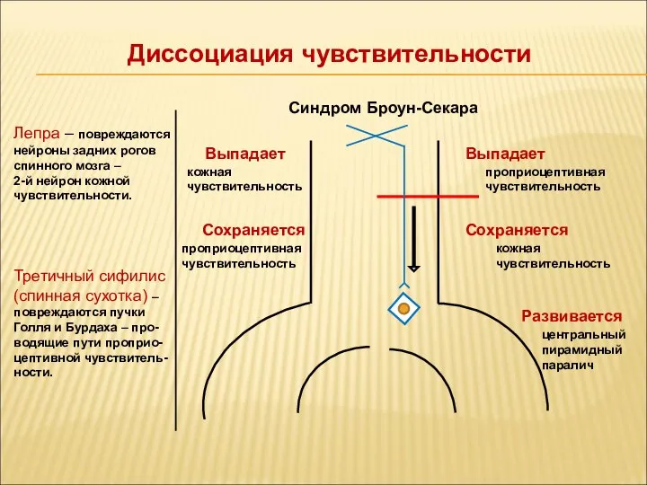 Диссоциация чувствительности Выпадает Сохраняется Выпадает Сохраняется проприоцептивная чувствительность кожная чувствительность кожная