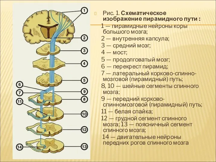 Рис. 1. Схематическое изображение пирамидного пути : 1 — пирамидные нейроны