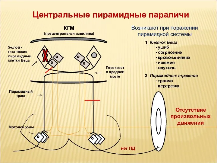 КГМ (прецентральная извилина) Центральные пирамидные параличи 5-слой - гигантские пирамидные клетки