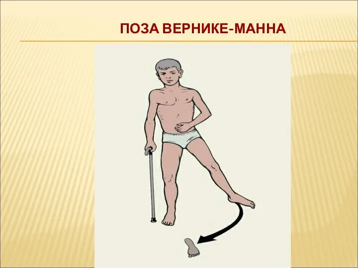 ПОЗА ВЕРНИКЕ-МАННА