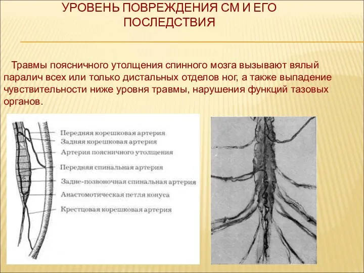 УРОВЕНЬ ПОВРЕЖДЕНИЯ СМ И ЕГО ПОСЛЕДСТВИЯ Травмы поясничного утолщения спинного мозга