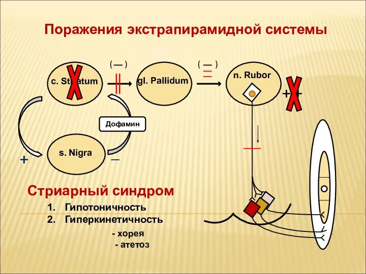 Поражения экстрапирамидной системы n. Rubor gl. Pallidum c. Striatum ( )