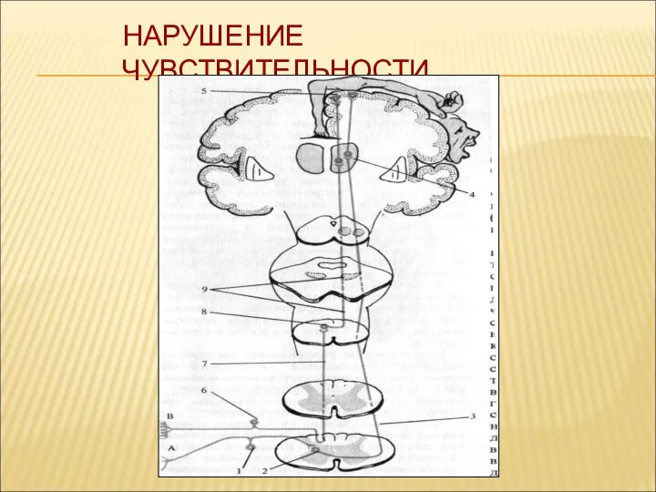 НАРУШЕНИЕ ЧУВСТВИТЕЛЬНОСТИ