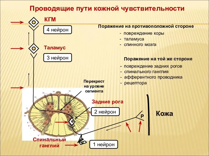 Спинальный ганглий 2 нейрон 1 нейрон Перекрест на уровне сегмента Таламус