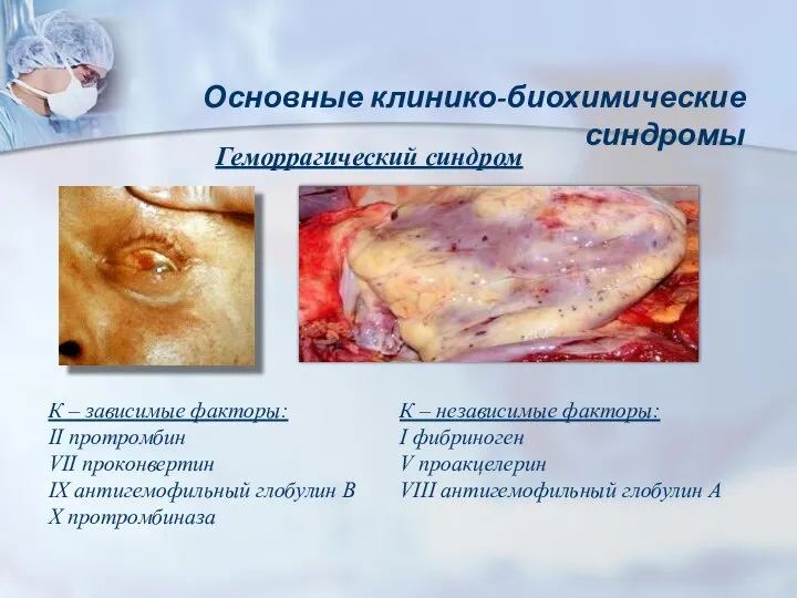 Основные клинико-биохимические синдромы Геморрагический синдром К – зависимые факторы: II протромбин