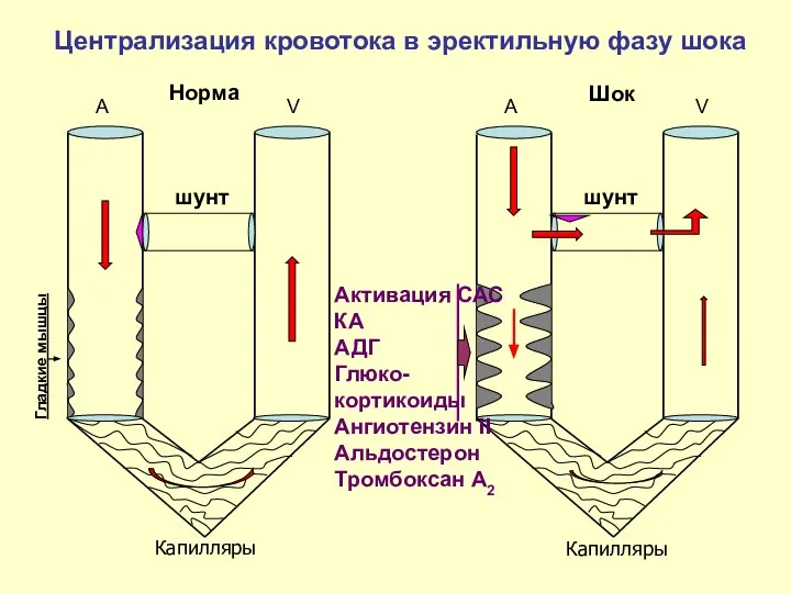 A V шунт Шок A V шунт Норма Централизация кровотока в