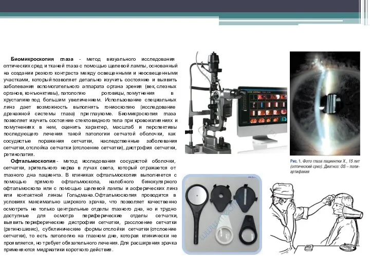 Биомикроскопия глаза - метод визуального исследования оптических сред и тканей глаза