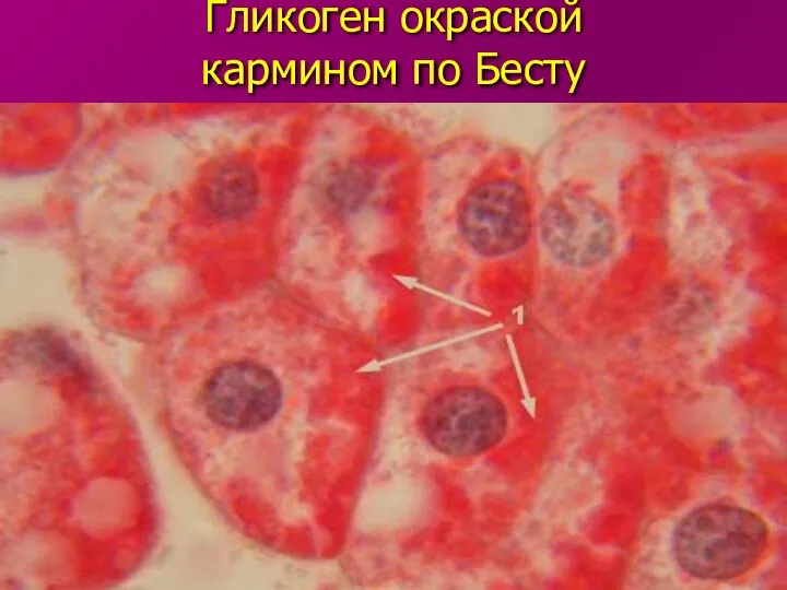 Гликоген окраской кармином по Бесту