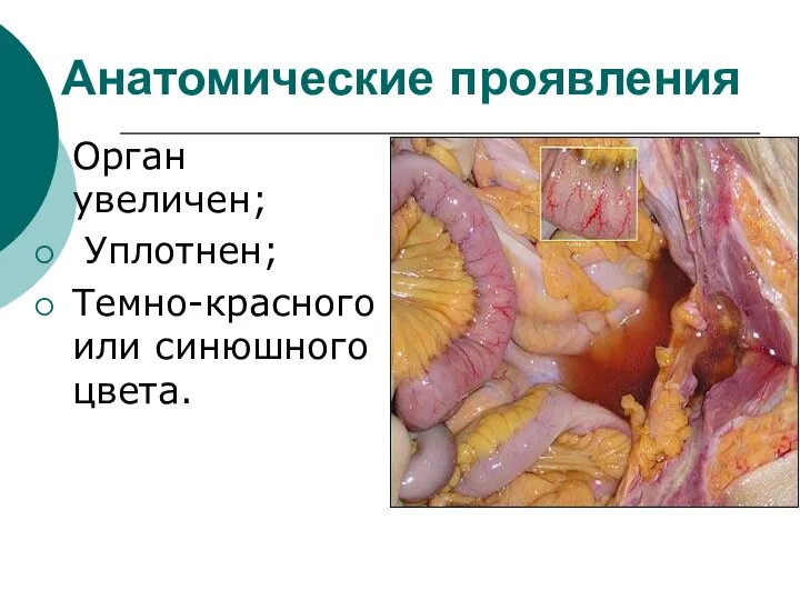 Анатомические проявления Орган увеличен; Уплотнен; Темно-красного или синюшного цвета.