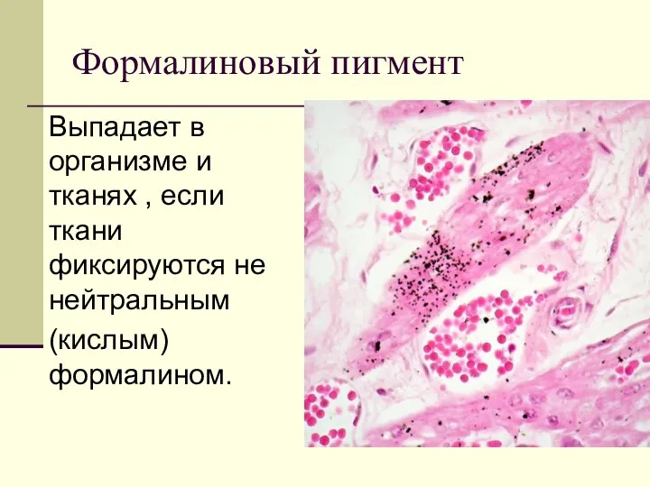 Формалиновый пигмент Выпадает в организме и тканях , если ткани фиксируются не нейтральным (кислым) формалином.