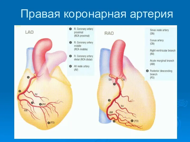 Правая коронарная артерия