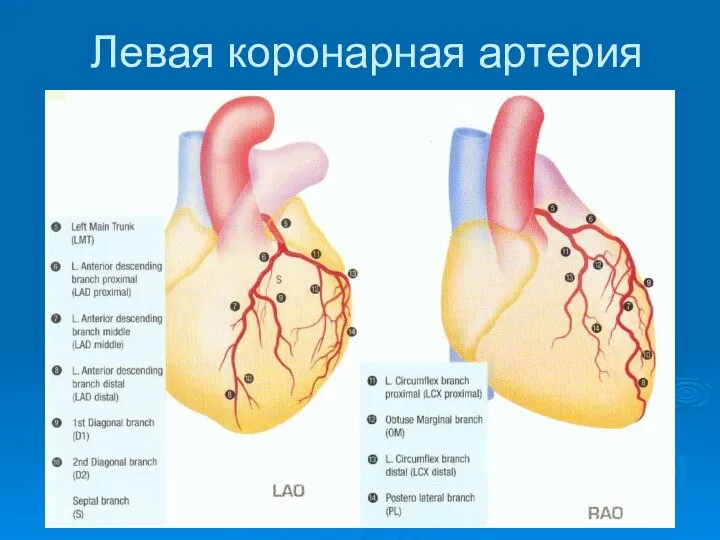 Левая коронарная артерия