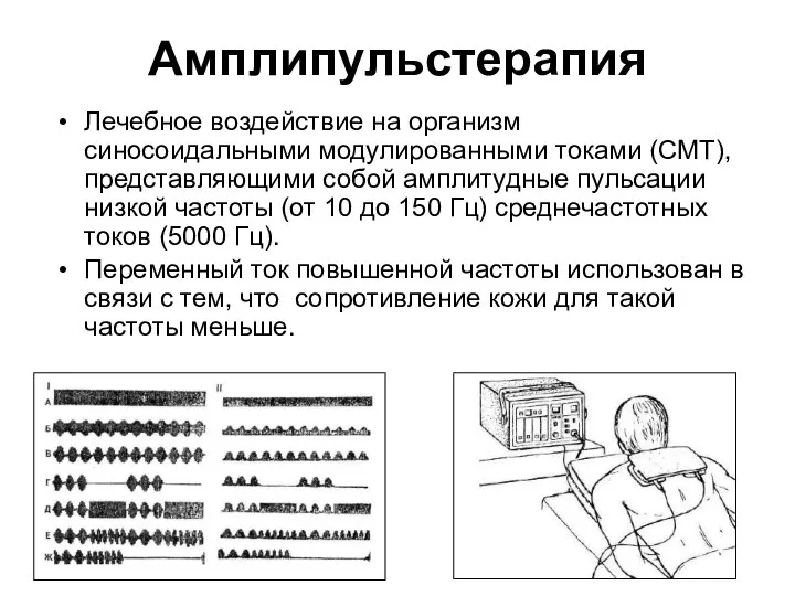 Амплипульстерапия Лечебное воздействие на организм синосоидальными модулированными токами (СМТ), представляющими собой