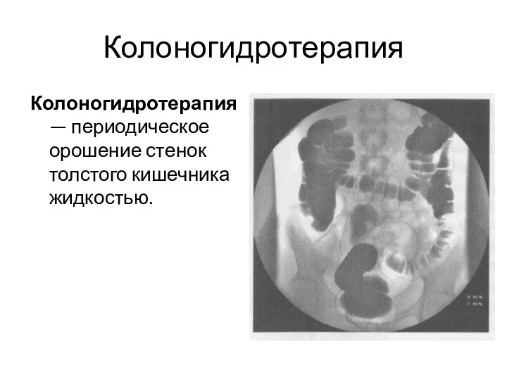 Колоногидротерапия Колоногидротерапия — периодическое орошение стенок толстого кишечника жидкостью.