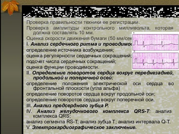 АНАЛИЗ ЭЛЕКТРОКАРДИОГРАММЫ: Проверка правильности техники ее регистрации. Проверка амплитуды контрольного милливольта,