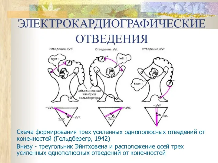 ЭЛЕКТРОКАРДИОГРАФИЧЕСКИЕ ОТВЕДЕНИЯ Схема формирования трех усиленных однополюсных отведений от конечностей (Гольдберегр,