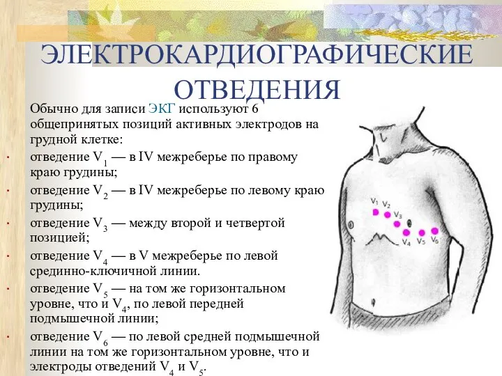 ЭЛЕКТРОКАРДИОГРАФИЧЕСКИЕ ОТВЕДЕНИЯ Обычно для записи ЭКГ используют 6 общепринятых позиций активных