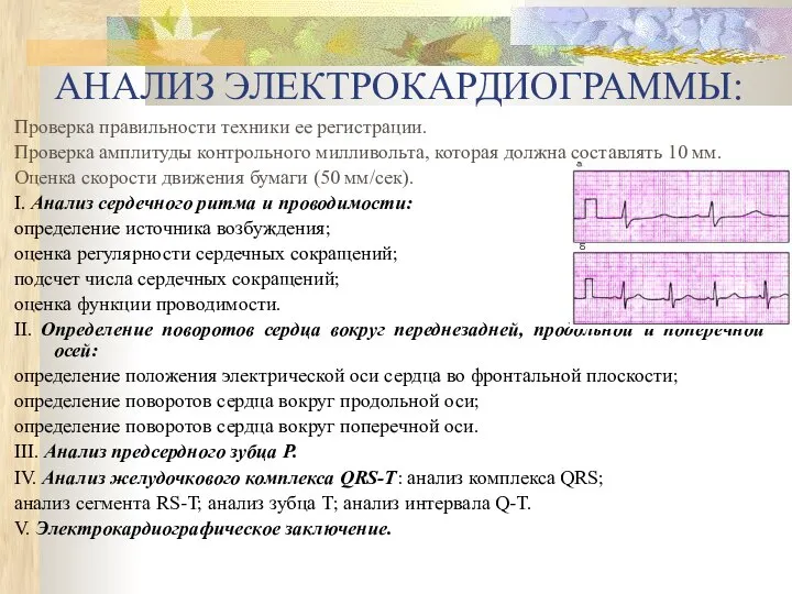 АНАЛИЗ ЭЛЕКТРОКАРДИОГРАММЫ: Проверка правильности техники ее регистрации. Проверка амплитуды контрольного милливольта,