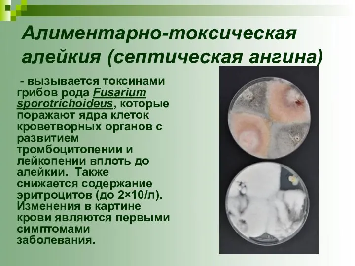 Алиментарно-токсическая алейкия (септическая ангина) - вызывается токсинами грибов рода Fusarium sporotrichоideus,