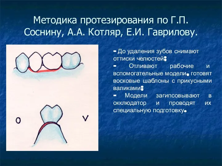 Методика протезирования по Г.П. Соснину, А.А. Котляр, Е.И. Гаврилову. - До