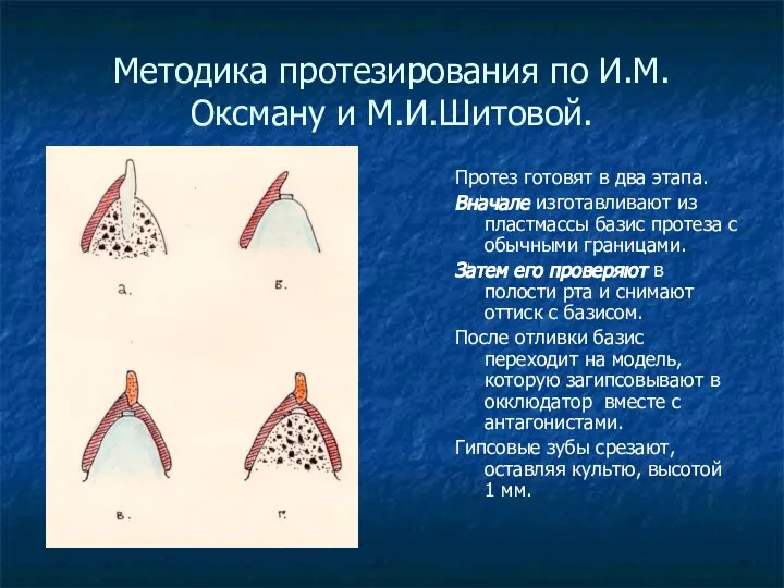 Методика протезирования по И.М.Оксману и М.И.Шитовой. Протез готовят в два этапа.