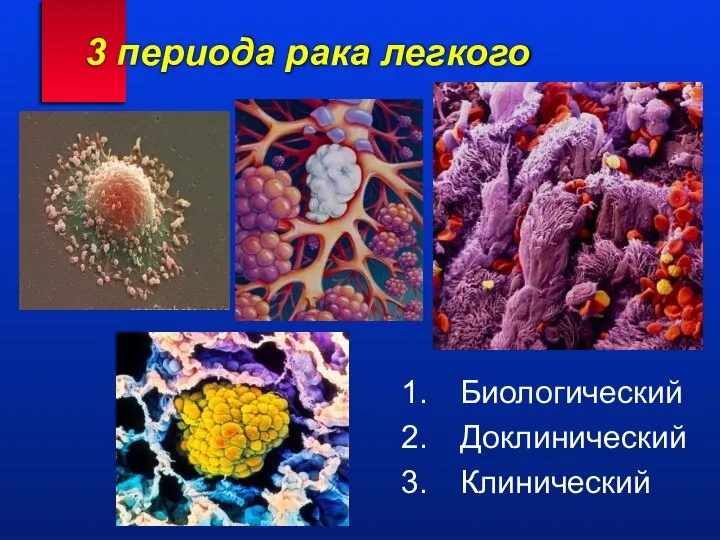 3 периода рака легкого Биологический Доклинический Клинический