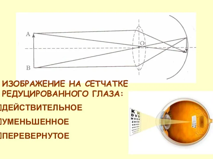 ИЗОБРАЖЕНИЕ НА СЕТЧАТКЕ РЕДУЦИРОВАННОГО ГЛАЗА: ДЕЙСТВИТЕЛЬНОЕ УМЕНЬШЕННОЕ ПЕРЕВЕРНУТОЕ