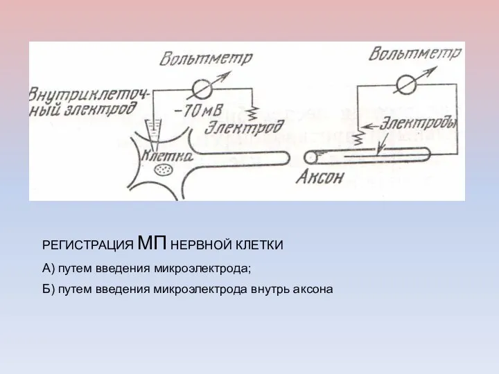 РЕГИСТРАЦИЯ МП НЕРВНОЙ КЛЕТКИ А) путем введения микроэлектрода; Б) путем введения микроэлектрода внутрь аксона