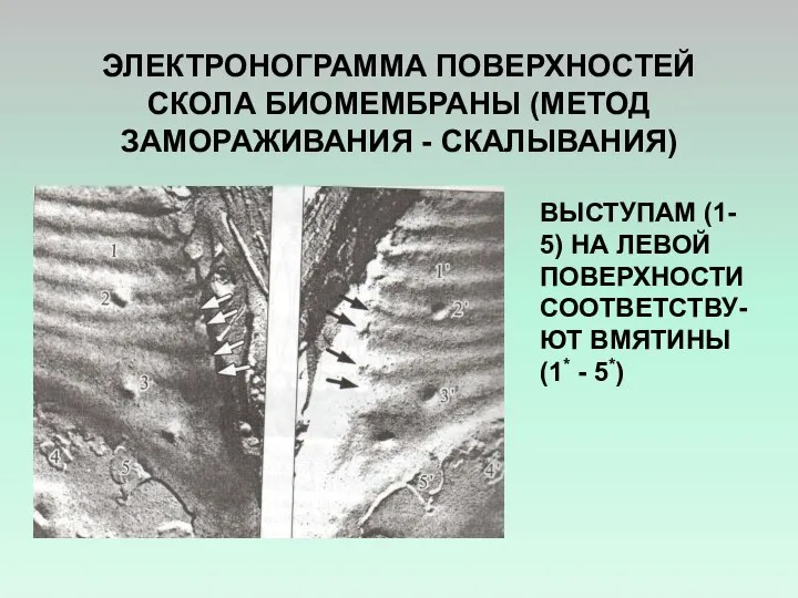 ЭЛЕКТРОНОГРАММА ПОВЕРХНОСТЕЙ СКОЛА БИОМЕМБРАНЫ (МЕТОД ЗАМОРАЖИВАНИЯ - СКАЛЫВАНИЯ) ВЫСТУПАМ (1- 5)