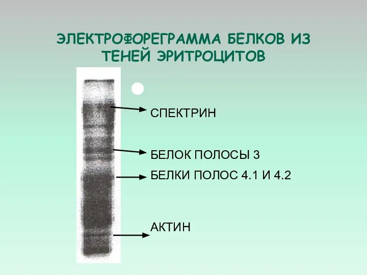 ЭЛЕКТРОФОРЕГРАММА БЕЛКОВ ИЗ ТЕНЕЙ ЭРИТРОЦИТОВ СПЕКТРИН БЕЛОК ПОЛОСЫ 3 БЕЛКИ ПОЛОС 4.1 И 4.2 АКТИН