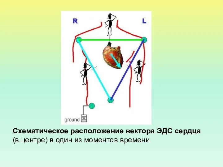 Схематическое расположение вектора ЭДС сердца (в центре) в один из моментов времени