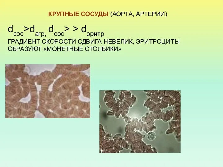 КРУПНЫЕ СОСУДЫ (АОРТА, АРТЕРИИ) dсос>dагр, dсос> > dэритр ГРАДИЕНТ СКОРОСТИ СДВИГА НЕВЕЛИК, ЭРИТРОЦИТЫ ОБРАЗУЮТ «МОНЕТНЫЕ СТОЛБИКИ»