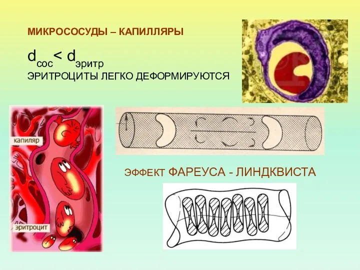 МИКРОСОСУДЫ – КАПИЛЛЯРЫ dсос ЭРИТРОЦИТЫ ЛЕГКО ДЕФОРМИРУЮТСЯ ЭФФЕКТ ФАРЕУСА - ЛИНДКВИСТА