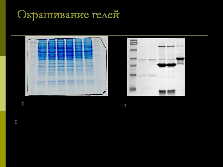 Окрашивание гелей Для визуализации результатов электрофореза чаще всего используют окрашивание белков