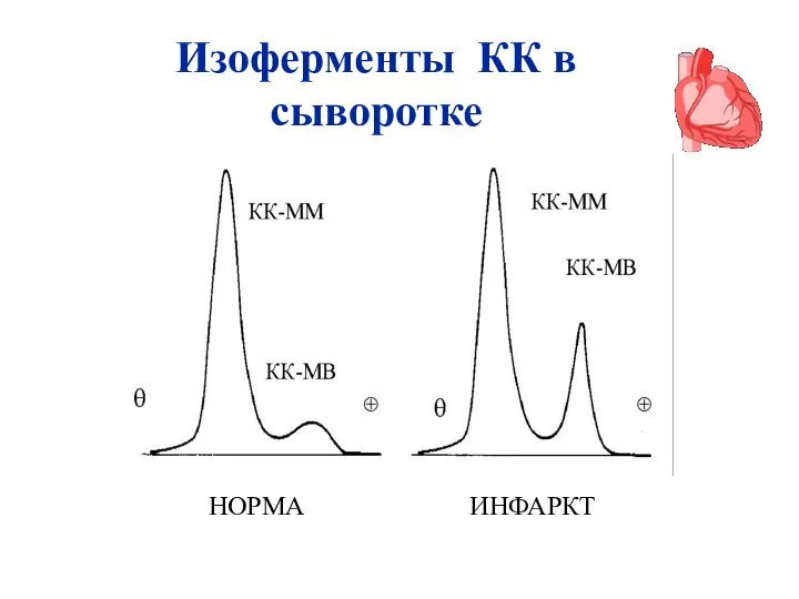 НОРМА ИНФАРКТ Изоферменты КК в сыворотке