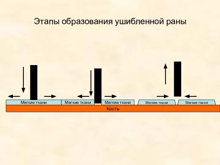 Этапы образования ушибленной раны Мягкие ткани Мягкие ткани Кость Мягкие ткани Мягкие ткани Мягкие ткани