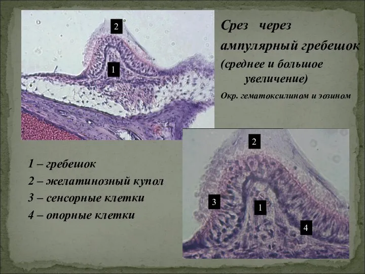 Срез через ампулярный гребешок (среднее и большое увеличение) 1 1 2