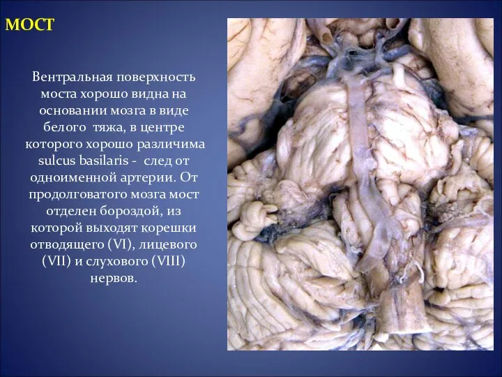 Вентральная поверхность моста хорошо видна на основании мозга в виде белого